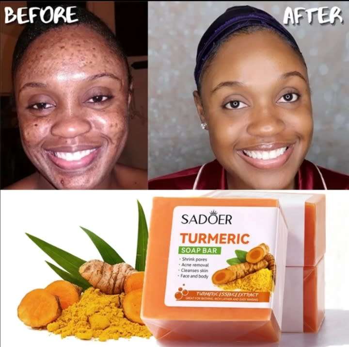 Sadoer Tumeric Soap