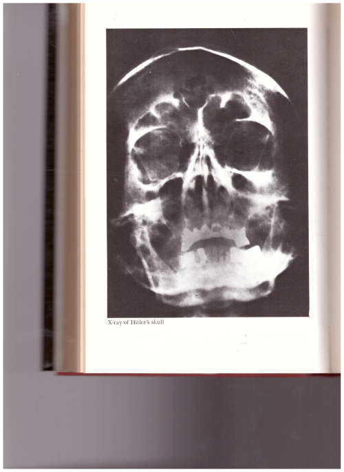 ADOLF HITLER: THE MEDICAL DIARIES, THE PRIVATE DIARIES OF DR. THEO MORELL