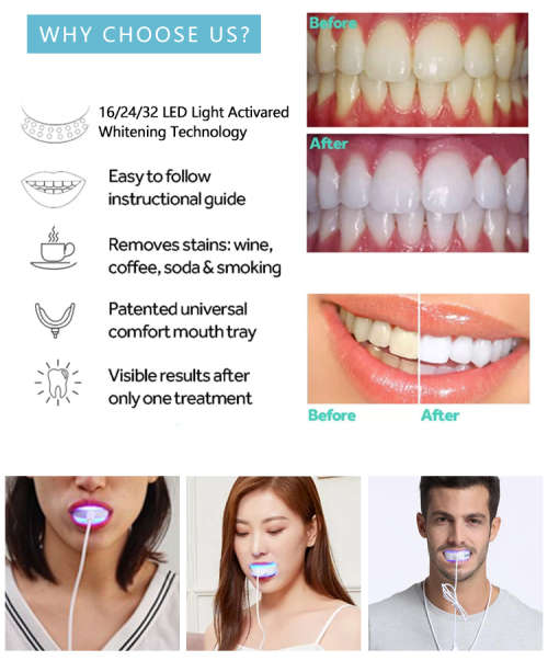 Advanced Teeth Whitening SmileKit- Snow manufacturers