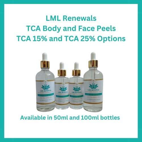 25% TCA Face and Body Peel 100mls (Trichloroacetic acid Face and Body Chemical Peel)
