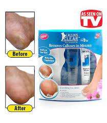 Callous clear