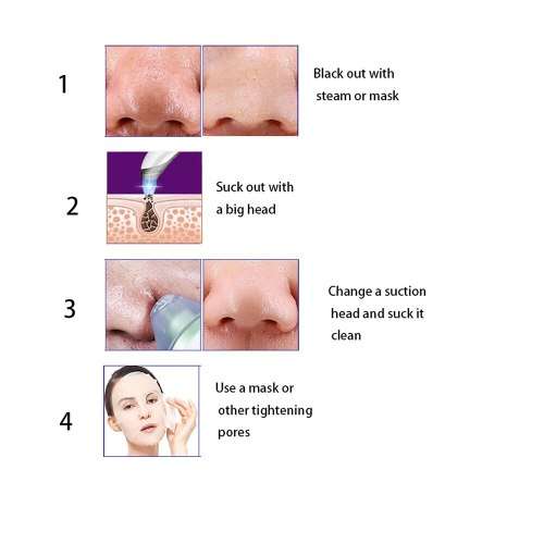 ACNE PORE SUCTION CLEANER