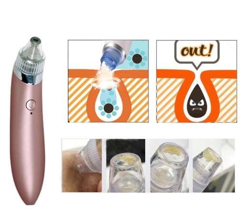 ACNE PORE SUCTION CLEANER