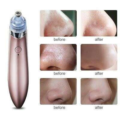 ACNE PORE SUCTION CLEANER