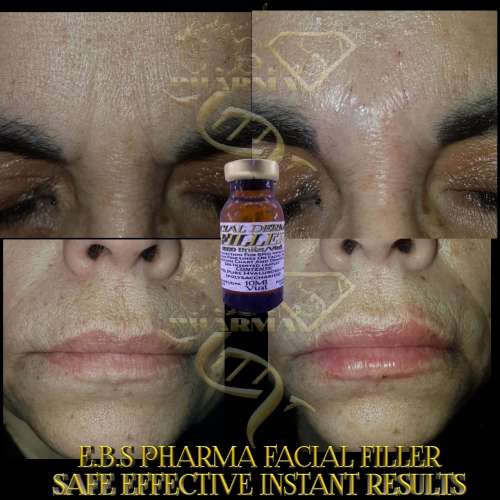 Facial FillerEbs Pharma Sa Facial Filler100 Unit Syringe