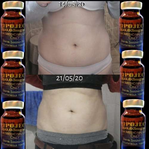 LipoLysis TreatmentEbs Pharma SaFlab To Fab Combo4x Lipojects1x Thinject