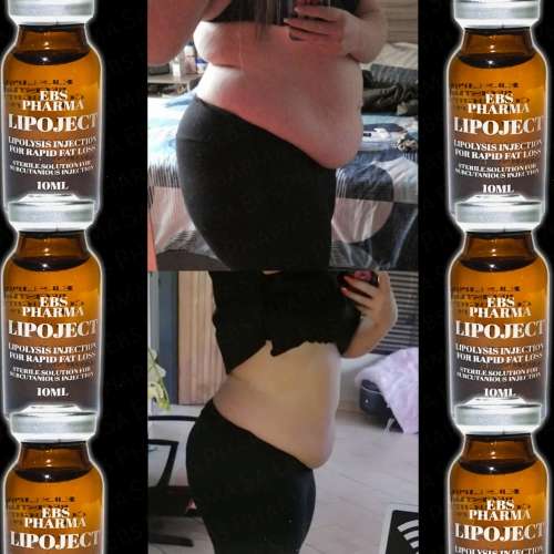 LipoLysis TreatmentEbs Pharma SaFlab To Fab Combo4x Lipojects1x Thinject