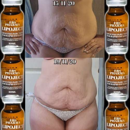 LipoLysis TreatmentEbs Pharma SaFlab To Fab Combo4x Lipojects1x Thinject