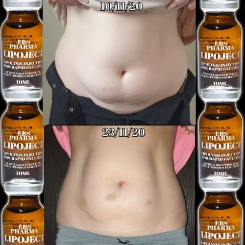 LipoLysis TreatmentEbs Pharma SaFlab To Fab Combo4x Lipojects1x Thinject