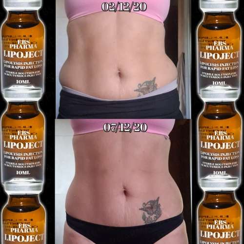LipoLysis TreatmentEbs Pharma SaFlab To Fab Combo4x Lipojects1x Thinject