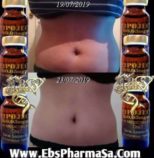 LipoLysis TreatmentEbs Pharma SaFlab To Fab Combo4x Lipojects1x Thinject