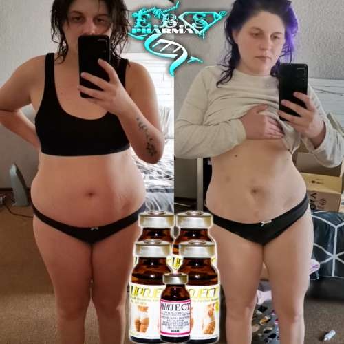 LipoLysis TreatmentEbs Pharma SaFlab To Fab Combo4x Lipojects1x Thinject