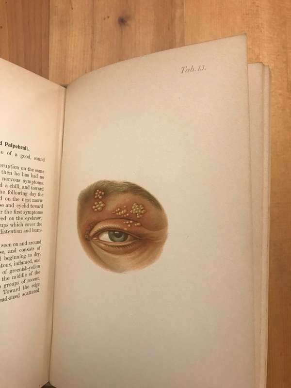 Atlas of diseases of the skin including an epitome of pathology and treatment  (Franz Mracek)