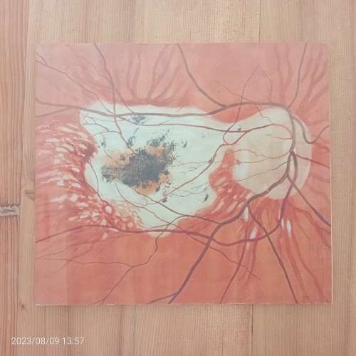 Tinus De Jongh As A Medical Artist (Signed by the author Janet Hodgson)