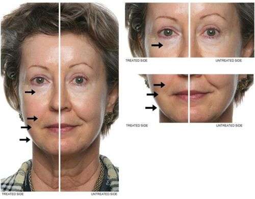 !BRAND NEW! ageLOC LumiSpa Beauty Device Face Cleansing Kit  Normal to Combo - NuSkin (New Skin)
