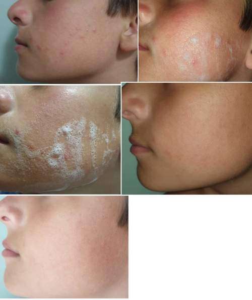 Organo Essentials Premium with Glutathion, Cleansing Soap Bar