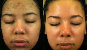 Organo Essentials Premium with Glutathion, Cleansing Soap Bar