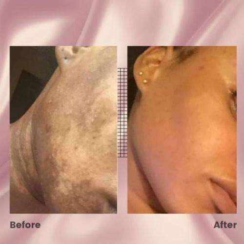 Organo Essentials Premium with Glutathion, Cleansing Soap Bar