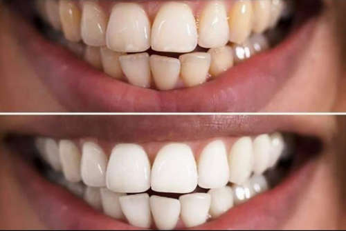 Whitening Fluoride Toothpaste AP 24