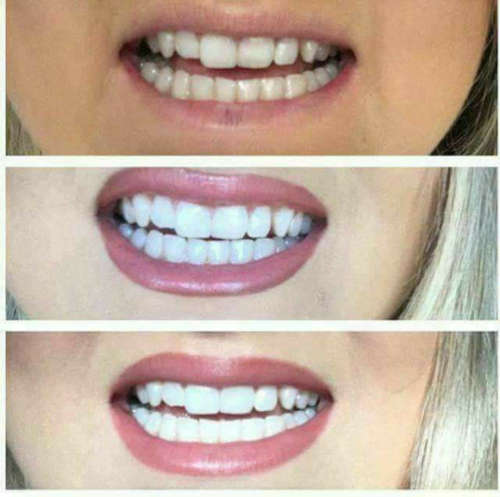 Whitening Fluoride Toothpaste AP 24