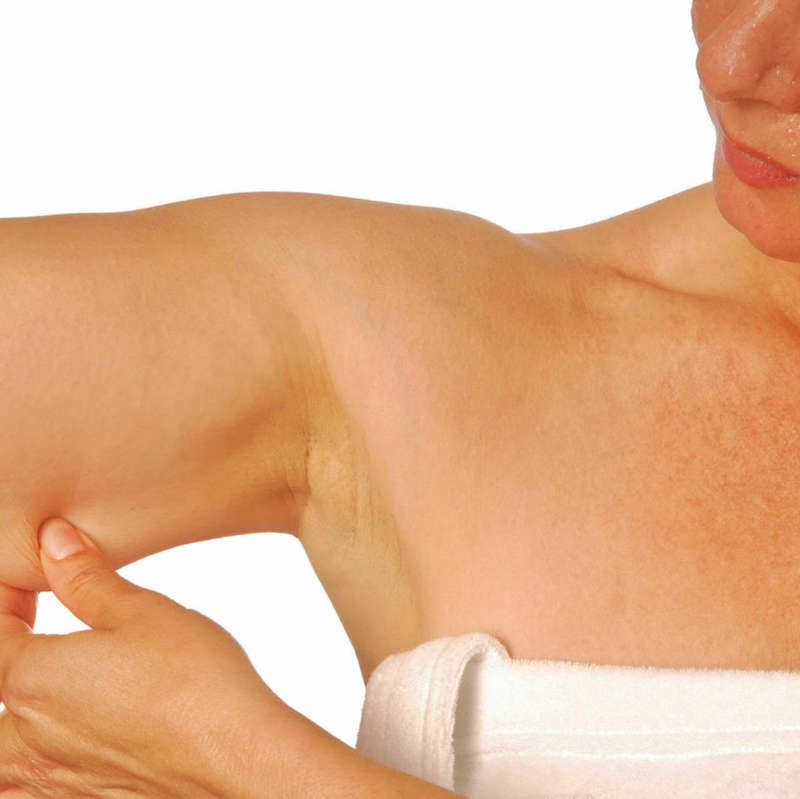 Why spend money on plastic surgery, injections and treatments when you can get an instant Arm Lift?