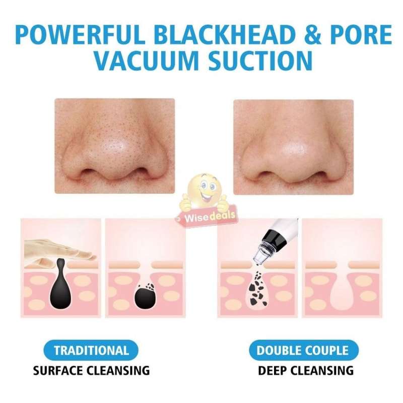 Electric Vacuum Blackhead Remover, Lift skin Elasticity and Make the Skin Tighten, More Radiant