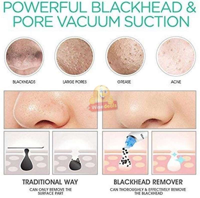 Electric Vacuum Blackhead Remover, Lift skin Elasticity and Make the Skin Tighten, More Radiant