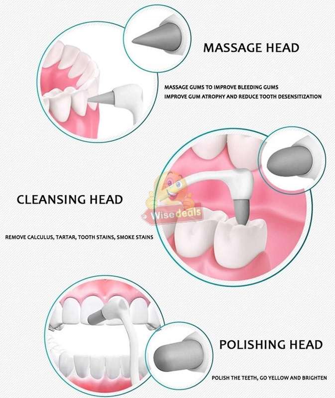 Electric Ultra-Sonic Acoustic Vibration Tooth Cleaner & Calculus Remover for beautiful teeth