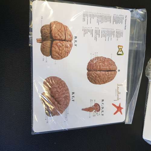 NEW!! GREAT anatomy model - human brain
