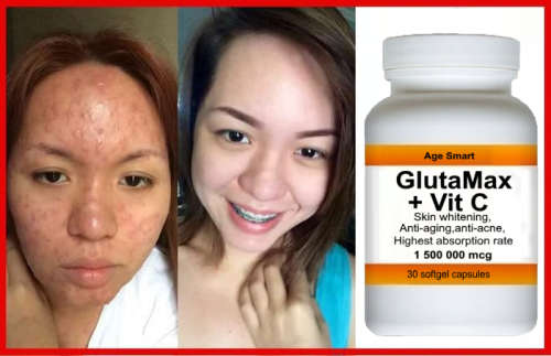GlutaMax Skin whitening brightening 30 softgels +Vit C.1500000 mcg. Glutathione