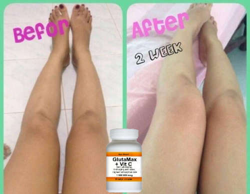 GlutaMax Skin whitening brightening 30 softgels +Vit C.1500000 mcg. Glutathione