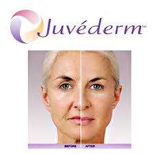 Special! Juvederm Dermal filler 2 x 1ml. Hyaluronic acid gel 24ml/ml Original. Made in France