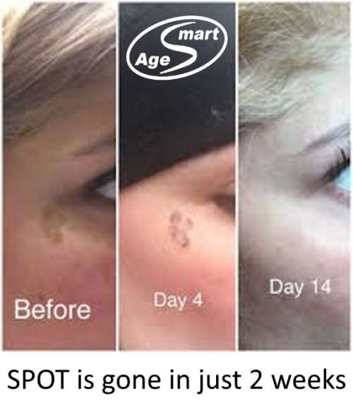 30 caps. Nano Glutathione+Q10 Whitening 1500000 mcg,Double chin gone V-line Skin tightening Slimming