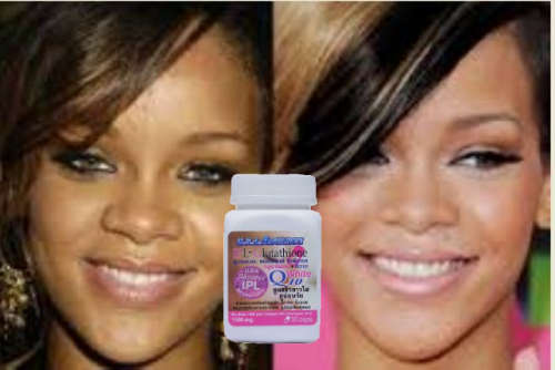 30 caps. Nano Glutathione+Q10 Whitening 1500000 mcg,Double chin gone V-line Skin tightening Slimming