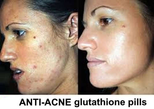 30 caps. Nano Glutathione+Q10 Whitening 1500000 mcg,Double chin gone V-line Skin tightening Slimming