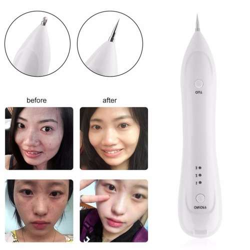 Instant plasma eyelid lift,scars,wart,spot,acne,eyebags,wrinkles.Same High tech Plasma pen as PlexR.