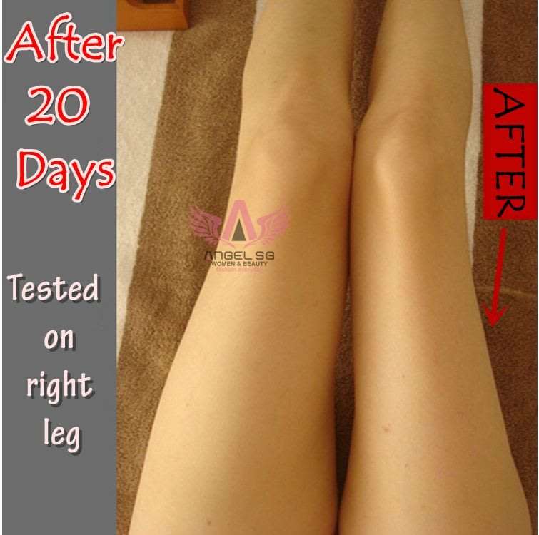 Cellulite gel cream 150ml.Lift hips and buttoks. Break fat slimming firming sculpting stretch mark
