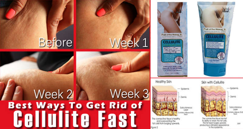Cellulite gel cream 150ml.Lift hips and buttoks. Break fat slimming firming sculpting stretch mark