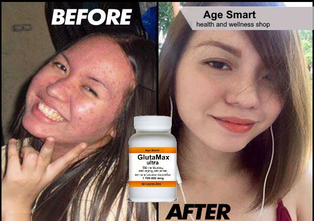 #1700000mcg Glutathione GlutaMax 60 caps.Skin whitening, anti-aging,detox,slimming. acne