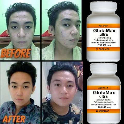 # 3+1 Christmas special.1700000mcg GlutaMax 30 caps.Skin whitening, anti-aging,detox,slimming acne
