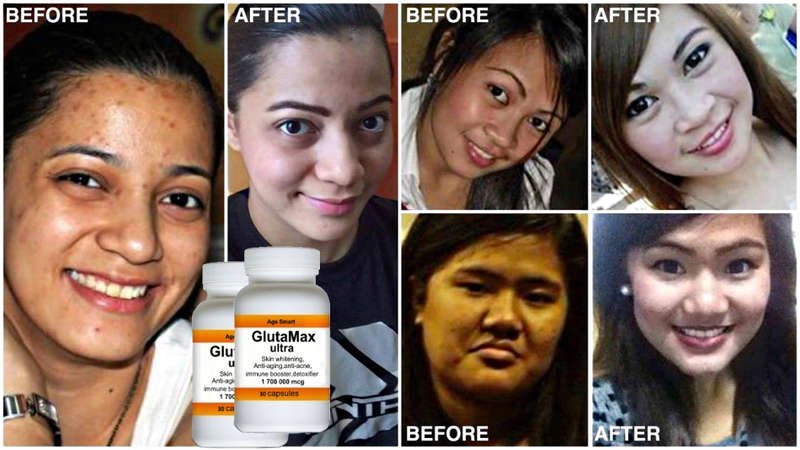 # 3+1 Christmas special.1700000mcg GlutaMax 30 caps.Skin whitening, anti-aging,detox,slimming acne
