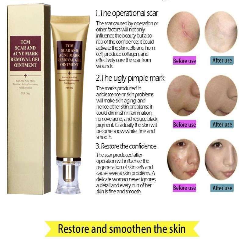 TCM skin scar & acne marks removal gel oitment.30g. anti-inflamatory repair .