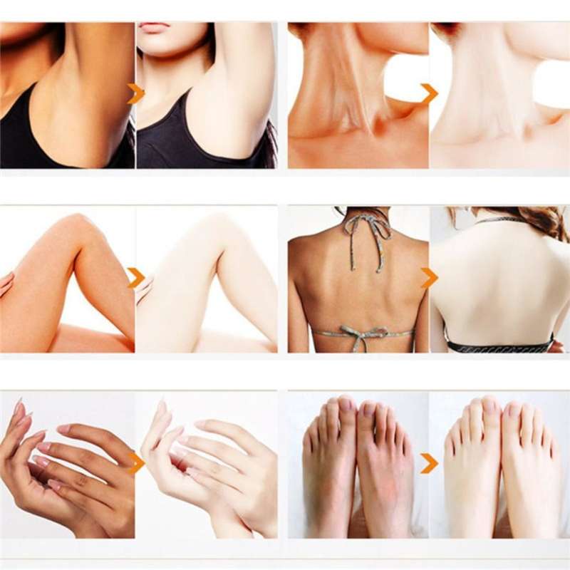 7 in 1 Nano white skin cream 80g. Yougurt milk remove smell,anti-inflammatory, repair wrinkles