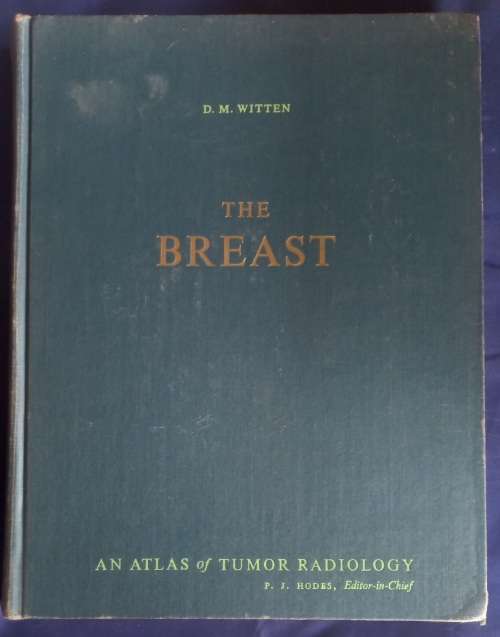 The breast by DM Witten