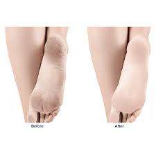 Foot grinding tool