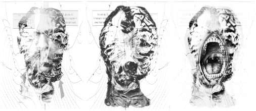 Art for Dentists by Ras Steyn - Monocrome Print (200X500mm) on HD Canson Paper (Hand Signed Edition)