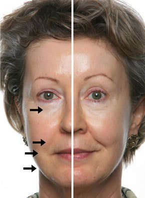 Galvanic Spa- NuSkin..Christmas SPECIAL