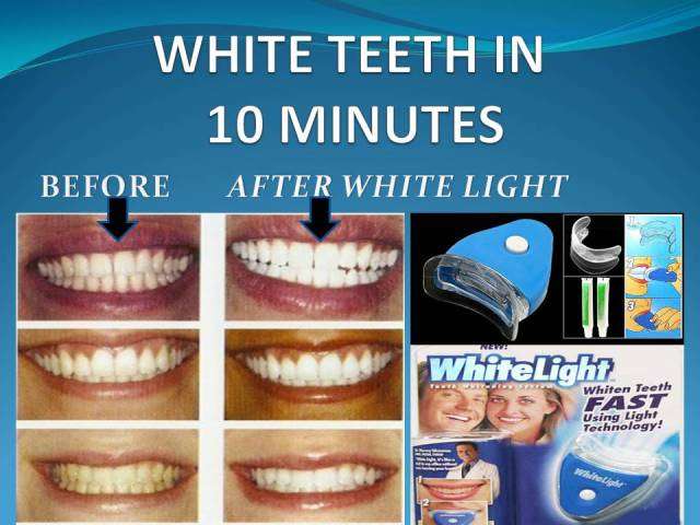 WHITE TEETH IN UNDER 10 MINUTES - WITH BLUE LIGHT TECHNOLOGY