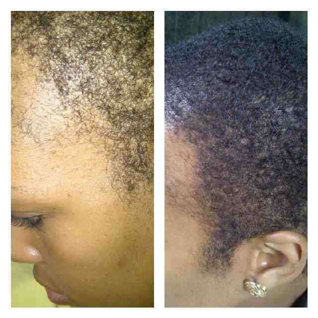 PEANIE HAIR GROWTH TONIC - shipping only R30-00 extra Get yours now!!!!