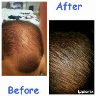 BALDING "Get your SEXY Back NOW" - HAIR EVOLUTION TONIC - shipping only R30-00 extra!!!